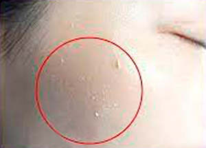 همین الان علت پیل شدن کرم ضد آفتاب روی پوست رو یاد بگیر!