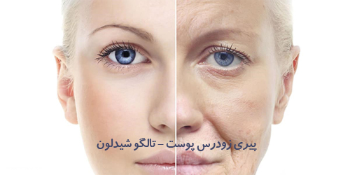 پیری زودرس پوست، تالگوشیدلون
