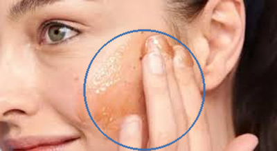 دلایل اصلی پیل شدن کرم